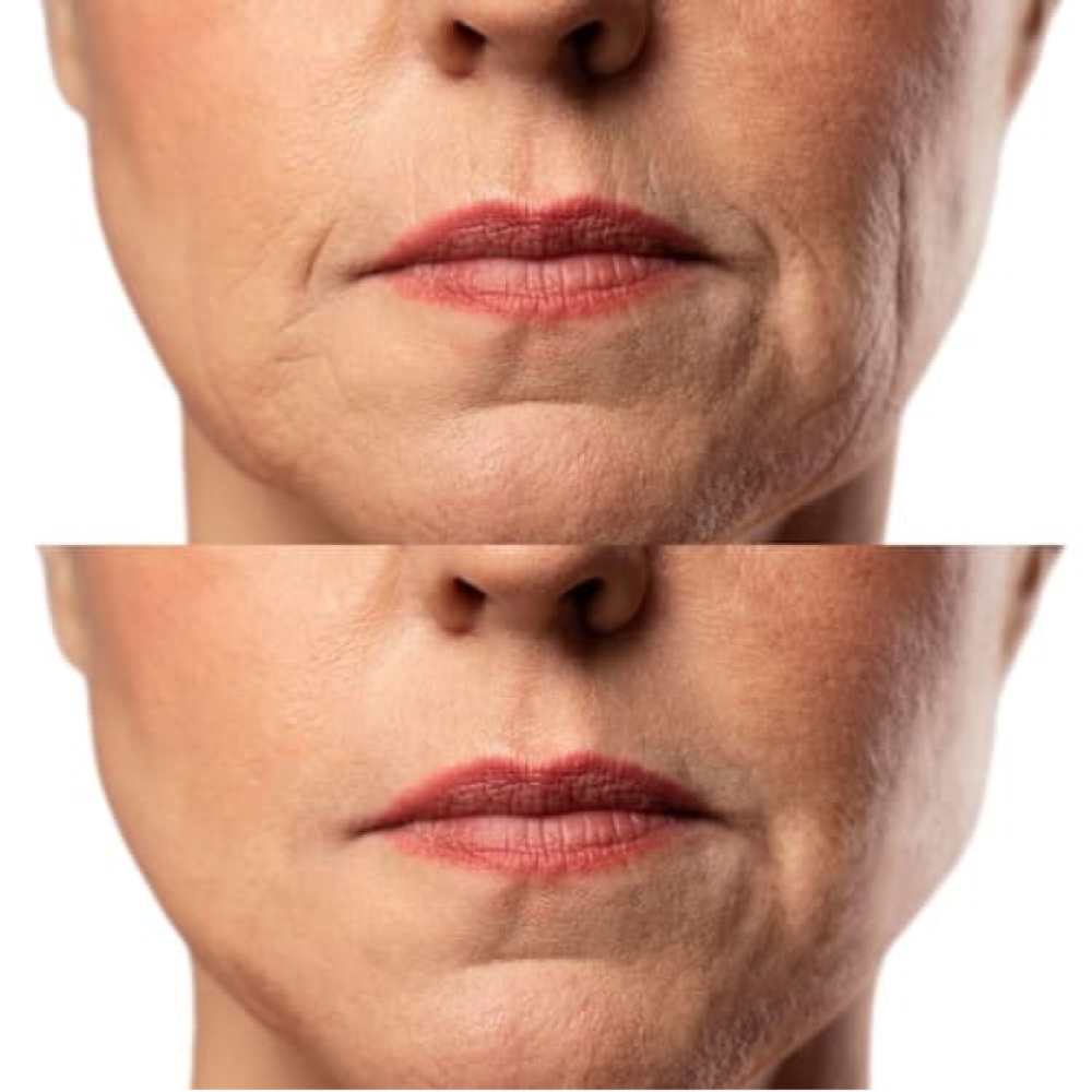 Mikroprądowy masażer do liftingu twarzy MEDICA+ Skin Lifting 7.0 White – EMS, LED (Japonia)