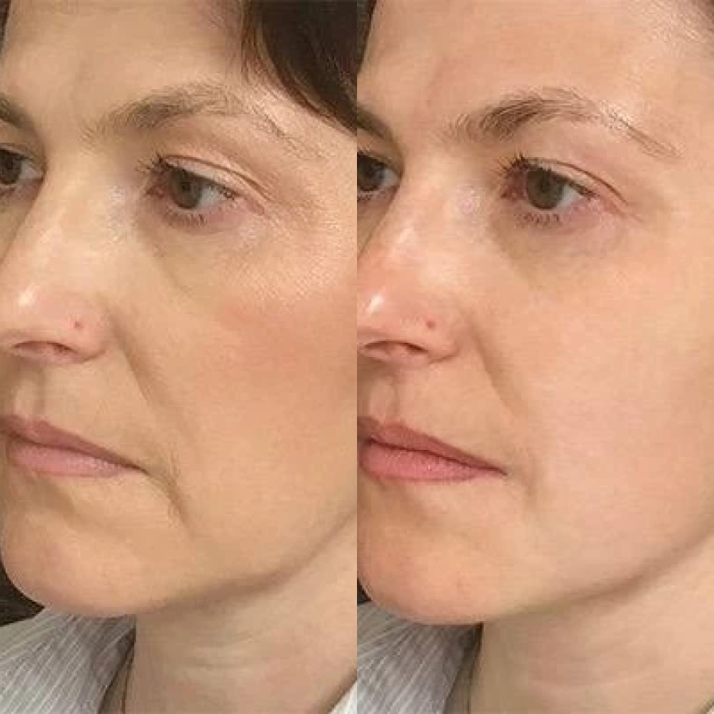 Maska zwężająca pory MEDICA+ Pore Control Mask (50 ml)