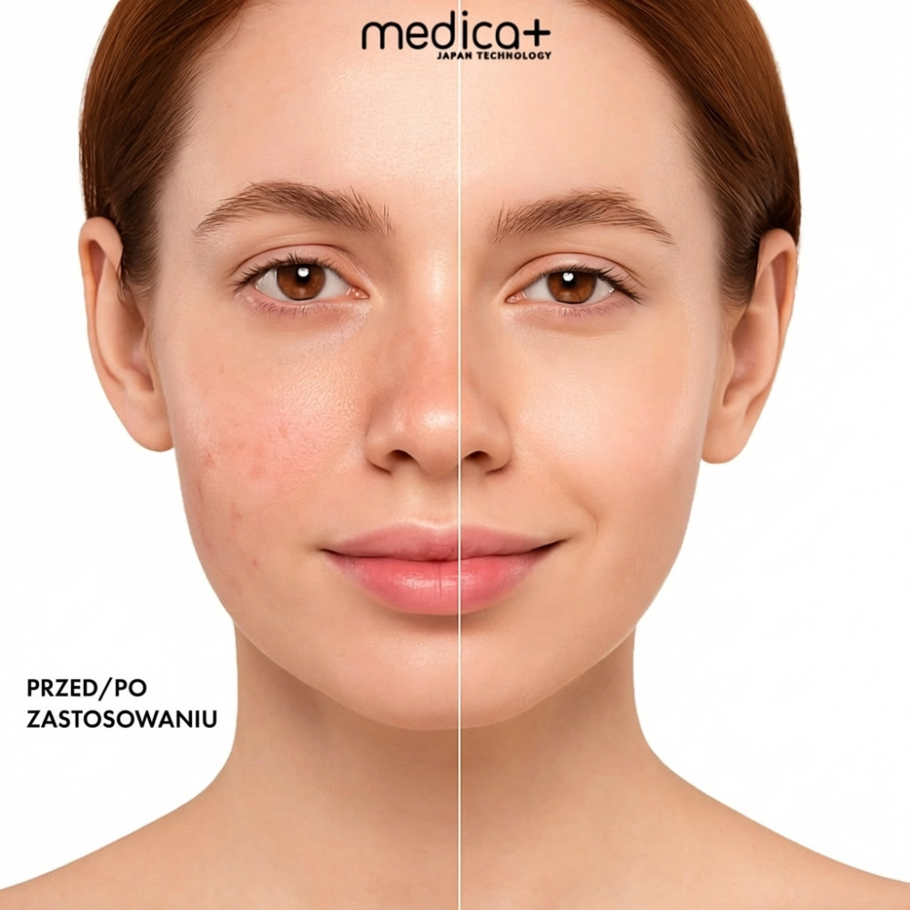 MEDICA+ LEDMask 8X – maska do terapii światłem LED (Japonia)