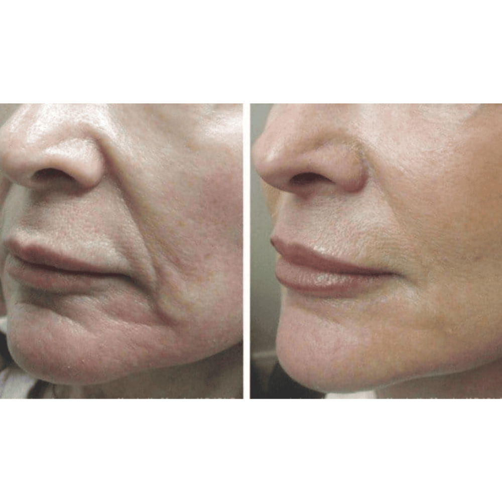 MEDICA+ Skin Lifting 5.0 Microcurrent Lifting Massager (Japan)