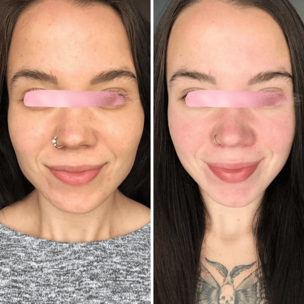 Lifting mikroprądowy MEDICA+ Skin Lifting 6.0 różowy (Japonia)